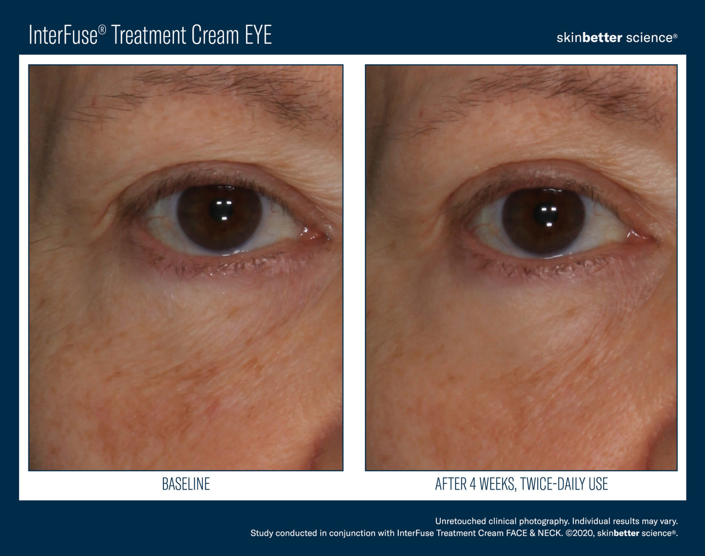 Interfuse Eye Cream
