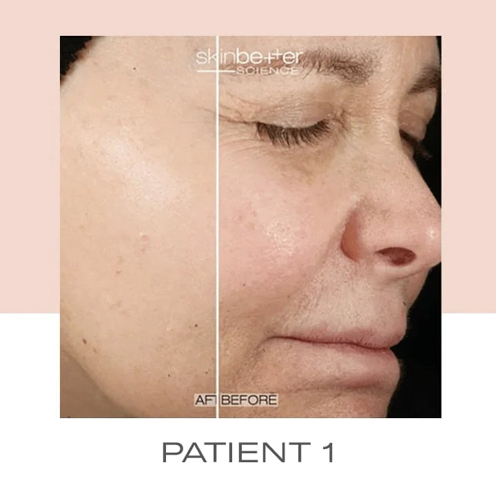 Even Tone Correcting Serum By SkinBetter Science